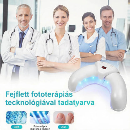 Hármas Körömápoló Lámpa – Napi 7 Perc a Tisztább és Egészségesebb Megjelenésű Körmökért