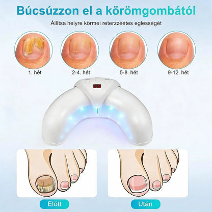 Hármas Körömápoló Lámpa – Napi 7 Perc a Tisztább és Egészségesebb Megjelenésű Körmökért